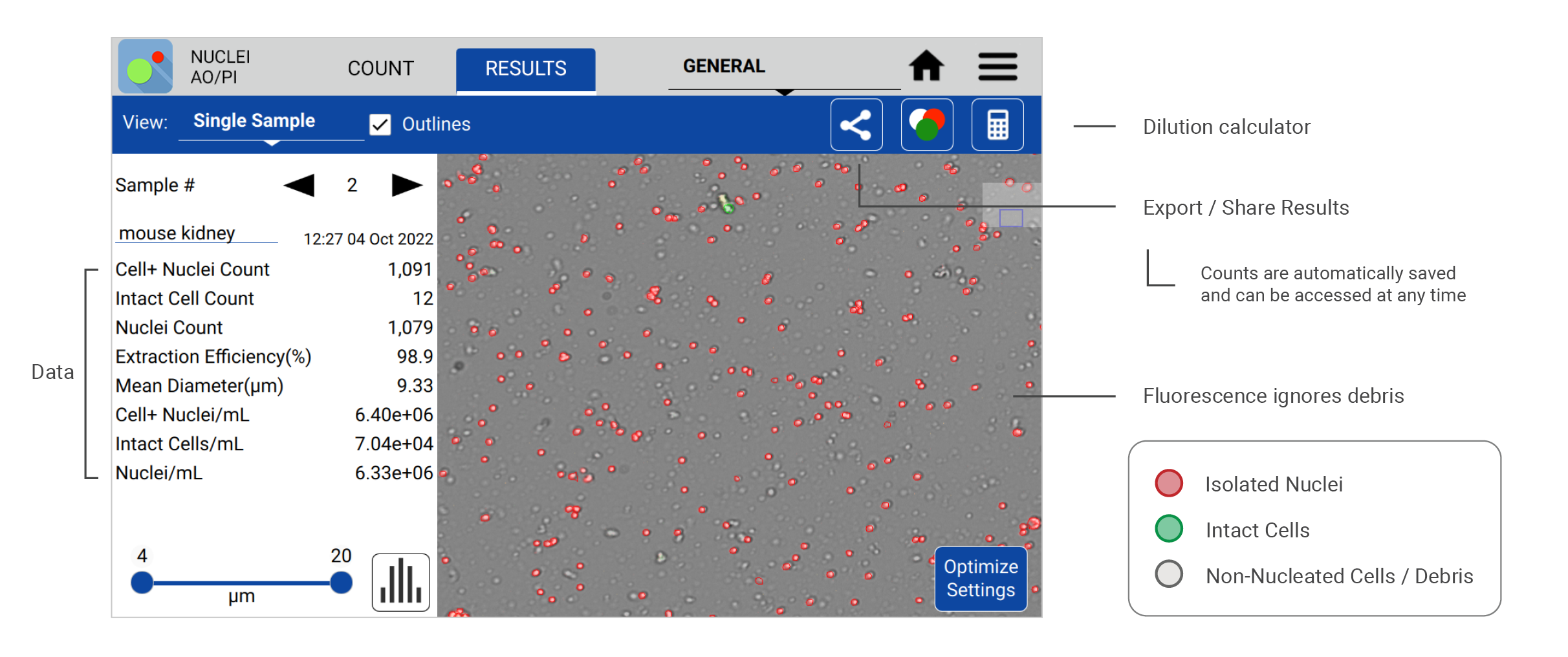 Nuclei Result Image Annotated